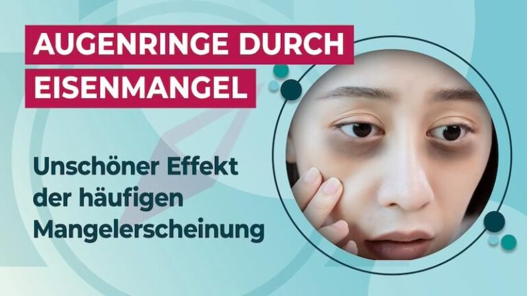 Augenringe bei Eisenmangel