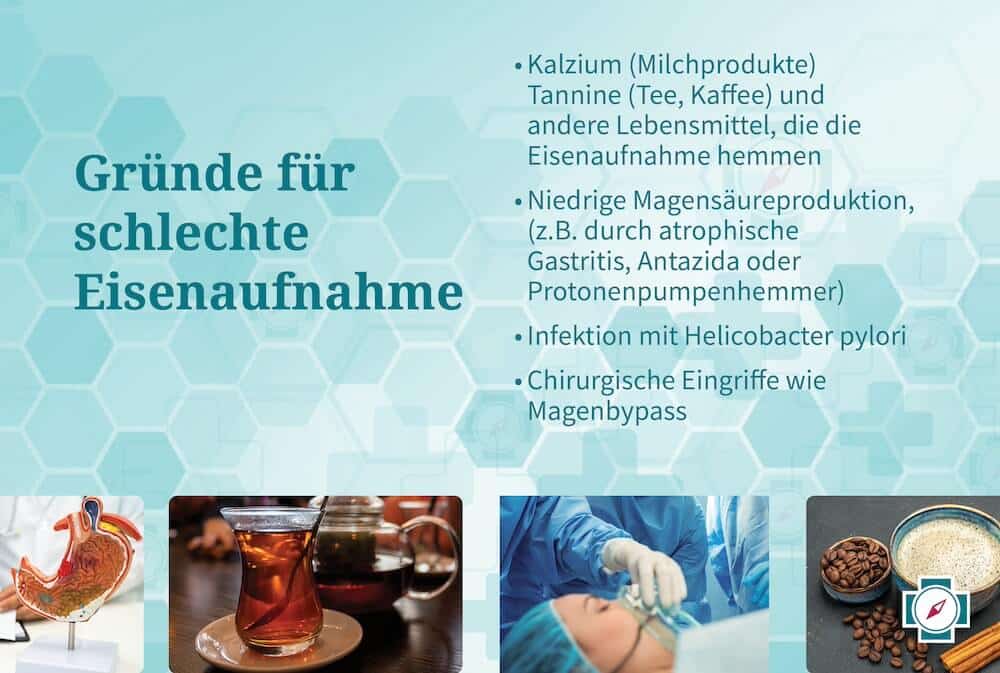 Augenringe durch Eisenmangel - Gründe für schlechte Eisenaufnahme