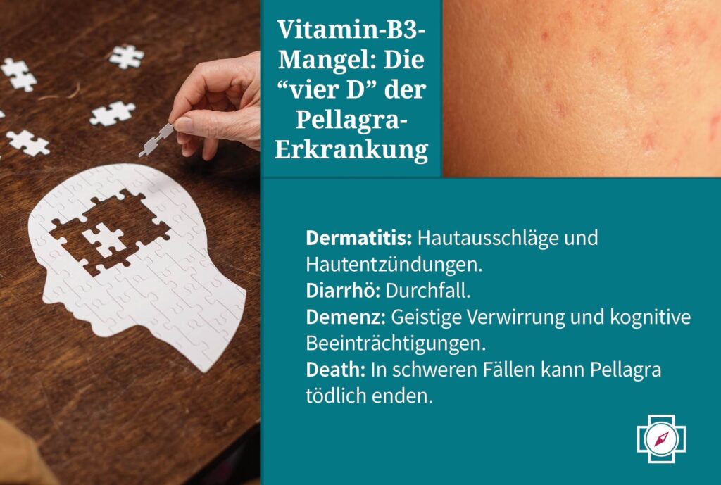 Vitamin B - Pellagra durch B3 Mangel